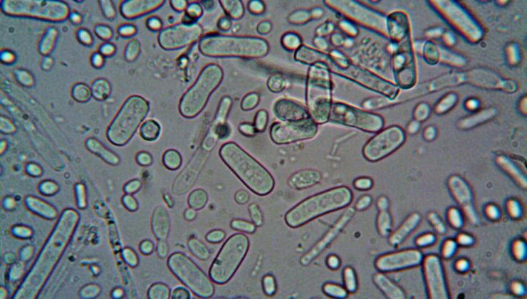 Escherichia coli